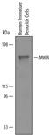 Mannose Receptor C-Type 1 antibody, AF2534, R&D Systems, Western Blot image 