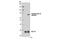 Lymphocyte Cytosolic Protein 2 antibody, 14745S, Cell Signaling Technology, Western Blot image 