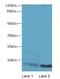 Cellular Retinoic Acid Binding Protein 1 antibody, LS-C318536, Lifespan Biosciences, Western Blot image 