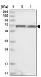 Phenylalanyl-TRNA Synthetase Subunit Beta antibody, NBP1-83923, Novus Biologicals, Western Blot image 