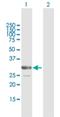 Armadillo Repeat Containing 10 antibody, H00083787-B01P, Novus Biologicals, Western Blot image 