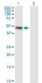 Cbl Proto-Oncogene C antibody, H00023624-M01, Novus Biologicals, Western Blot image 