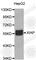 X-Linked Inhibitor Of Apoptosis antibody, A0383, ABclonal Technology, Western Blot image 