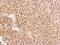 Exosome Component 3 antibody, NBP2-16392, Novus Biologicals, Immunohistochemistry paraffin image 