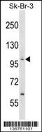 Protein Phosphatase 1 Regulatory Subunit 13B antibody, 59-018, ProSci, Western Blot image 