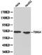 Transforming Growth Factor Beta Regulator 4 antibody, LS-C192353, Lifespan Biosciences, Western Blot image 