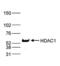 Histone Deacetylase 1 antibody, NBP2-59239, Novus Biologicals, Western Blot image 