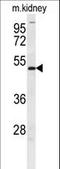 Doublesex And Mab-3 Related Transcription Factor 3 antibody, LS-C167453, Lifespan Biosciences, Western Blot image 