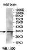 Ankyrin Repeat Domain 23 antibody, orb78081, Biorbyt, Western Blot image 
