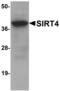 NAD-dependent ADP-ribosyltransferase sirtuin-4 antibody, LS-C115842, Lifespan Biosciences, Western Blot image 