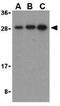 BH3 Interacting Domain Death Agonist antibody, GTX31689, GeneTex, Western Blot image 