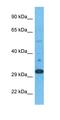 ELOVL Fatty Acid Elongase 1 antibody, orb325508, Biorbyt, Western Blot image 