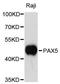 Paired Box 5 antibody, A3068, ABclonal Technology, Western Blot image 