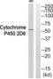 Cytochrome P450 Family 2 Subfamily D Member 6 antibody, abx015138, Abbexa, Western Blot image 