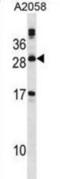 Phospholipase A2 Group XIIA antibody, abx028956, Abbexa, Western Blot image 