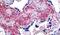 Neuroepithelial Cell Transforming 1 antibody, PA5-33965, Invitrogen Antibodies, Immunohistochemistry paraffin image 