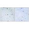 Zinc Finger Homeobox 3 antibody, PA5-49830, Invitrogen Antibodies, Immunohistochemistry frozen image 