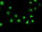 STE20/SPS1-related proline-alanine-rich protein kinase antibody, MA5-24935, Invitrogen Antibodies, Immunocytochemistry image 