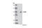 Forkhead Box M1 antibody, 5436P, Cell Signaling Technology, Western Blot image 