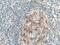 Interleukin 12 Receptor Subunit Beta 1 antibody, 13287-1-AP, Proteintech Group, Immunohistochemistry paraffin image 