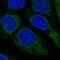 Sterol O-acyltransferase 1 antibody, PA5-61455, Invitrogen Antibodies, Immunofluorescence image 