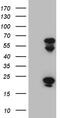 TRNA Methyltransferase 12 Homolog antibody, TA809537, Origene, Western Blot image 
