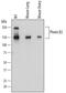 Plexin B2 antibody, PA5-47880, Invitrogen Antibodies, Western Blot image 