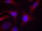 NFKB Inhibitor Alpha antibody, GTX50209, GeneTex, Immunofluorescence image 