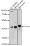 Glycine Amidinotransferase antibody, GTX33216, GeneTex, Western Blot image 