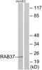 RAB37, Member RAS Oncogene Family antibody, PA5-39404, Invitrogen Antibodies, Western Blot image 