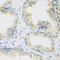 UPF2 Regulator Of Nonsense Mediated MRNA Decay antibody, 22-689, ProSci, Immunohistochemistry paraffin image 
