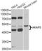 A-Kinase Anchoring Protein 5 antibody, LS-C749102, Lifespan Biosciences, Western Blot image 