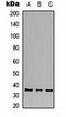 Calcium Voltage-Gated Channel Auxiliary Subunit Gamma 5 antibody, orb323240, Biorbyt, Western Blot image 