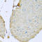 Transmembrane Protein 173 antibody, LS-C332665, Lifespan Biosciences, Immunohistochemistry paraffin image 