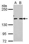 Fanconi anemia group J protein antibody, GTX113996, GeneTex, Western Blot image 