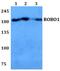 Roundabout Guidance Receptor 1 antibody, PA5-75814, Invitrogen Antibodies, Western Blot image 