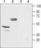 Potassium Voltage-Gated Channel Subfamily J Member 16 antibody, PA5-77637, Invitrogen Antibodies, Western Blot image 