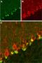 Potassium Voltage-Gated Channel Subfamily A Regulatory Beta Subunit 2 antibody, PA5-77631, Invitrogen Antibodies, Immunohistochemistry paraffin image 