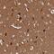 ADAM Metallopeptidase With Thrombospondin Type 1 Motif 18 antibody, NBP1-91651, Novus Biologicals, Immunohistochemistry paraffin image 