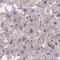 Aldehyde Dehydrogenase 16 Family Member A1 antibody, HPA059488, Atlas Antibodies, Immunohistochemistry paraffin image 