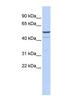 Potassium Two Pore Domain Channel Subfamily K Member 12 antibody, NBP1-80084, Novus Biologicals, Western Blot image 