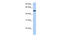 Polypeptide N-Acetylgalactosaminyltransferase 13 antibody, 26-493, ProSci, Western Blot image 