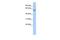 Carcinoembryonic Antigen Related Cell Adhesion Molecule 16 antibody, GTX46613, GeneTex, Western Blot image 