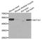 AKT1 Substrate 1 antibody, STJ27994, St John