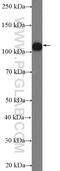 Kiaa0692 antibody, 26293-1-AP, Proteintech Group, Western Blot image 