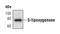 Arachidonate 5-Lipoxygenase antibody, MA5-14838, Invitrogen Antibodies, Western Blot image 
