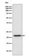 TIMP Metallopeptidase Inhibitor 2 antibody, M01037-1, Boster Biological Technology, Western Blot image 