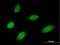 MMS19 Homolog, Cytosolic Iron-Sulfur Assembly Component antibody, H00064210-B01P, Novus Biologicals, Immunofluorescence image 