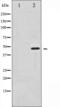 Synaptotagmin 1 antibody, GTX52317, GeneTex, Western Blot image 