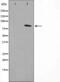 Nuclear Receptor Subfamily 3 Group C Member 1 antibody, abx011849, Abbexa, Western Blot image 